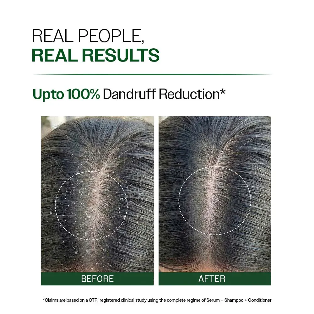 bare anatomy1.webp