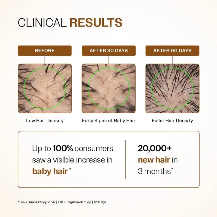 Advanced Hair Growth Serum With 3% Redensyl, 4% Anagain, & 1% Capilia Longa - 30 ml1.webp