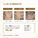 Advanced Hair Growth Serum With 3% Redensyl, 4% Anagain, & 1% Capilia Longa - 30 ml1.webp